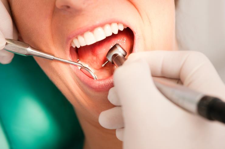 Dental Cleanings